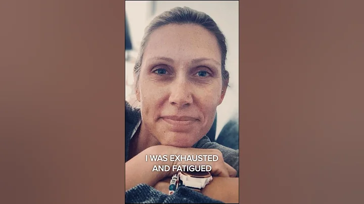 My Ovarian Cancer Symptoms! "I was Tired and Stressed!"