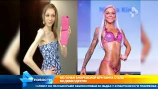 Больная анорексией британка стала бодибилдером Больная анорексией британка стала бодибилдером