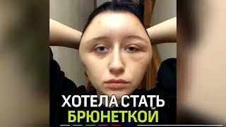 У парижанки из-за краски для волос опухла голова