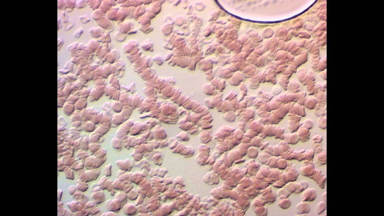 HUMAN BLOOD: Fibrin mesh