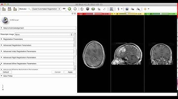 image registration in 3d slicer expert automated Affine Registration