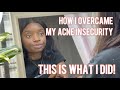 If your acne makes you insecure, watch this.