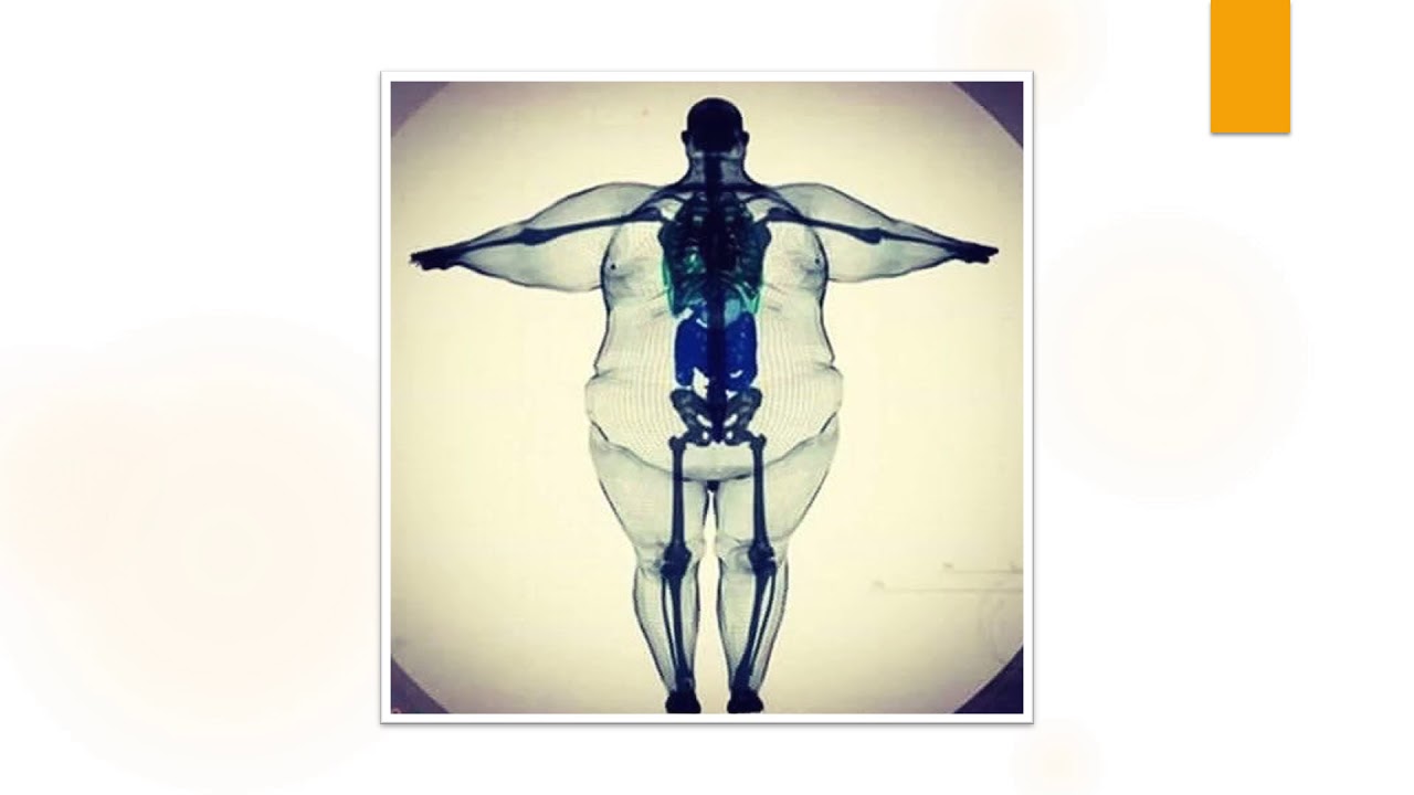 Curso Básico Ultrassom 1 Aula - Definindo PoCUS