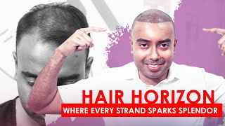 Hair Transplant Surgery Experience and Review in Bangalore | New Roots Hair Clinic