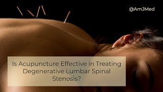 Is Acupuncture Effective in Treating Low Back Pain?