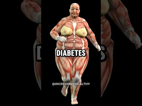 شاهد هذا ولن تلمس السكر أبد ا سكر داء السكري سكر الدم مستويات الجلوكوز