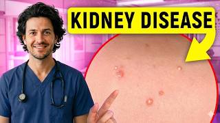 17 Signs of KIDNEY DISEASE You Can See: Doctor Explains