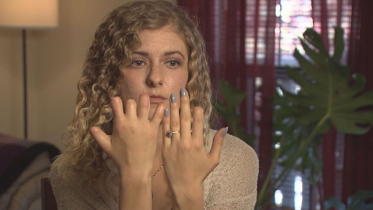 How Woman With Untreated Strep Throat Is Coping After Losing Fingers and Toes