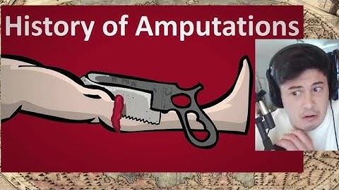 Watching The History of Amputation Explained