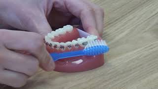 Brossage dents avec appareil dentaire