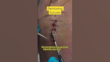 Satisfying Removal of Sutures #asmr