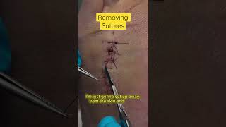 Satisfying Removal of Sutures #asmr