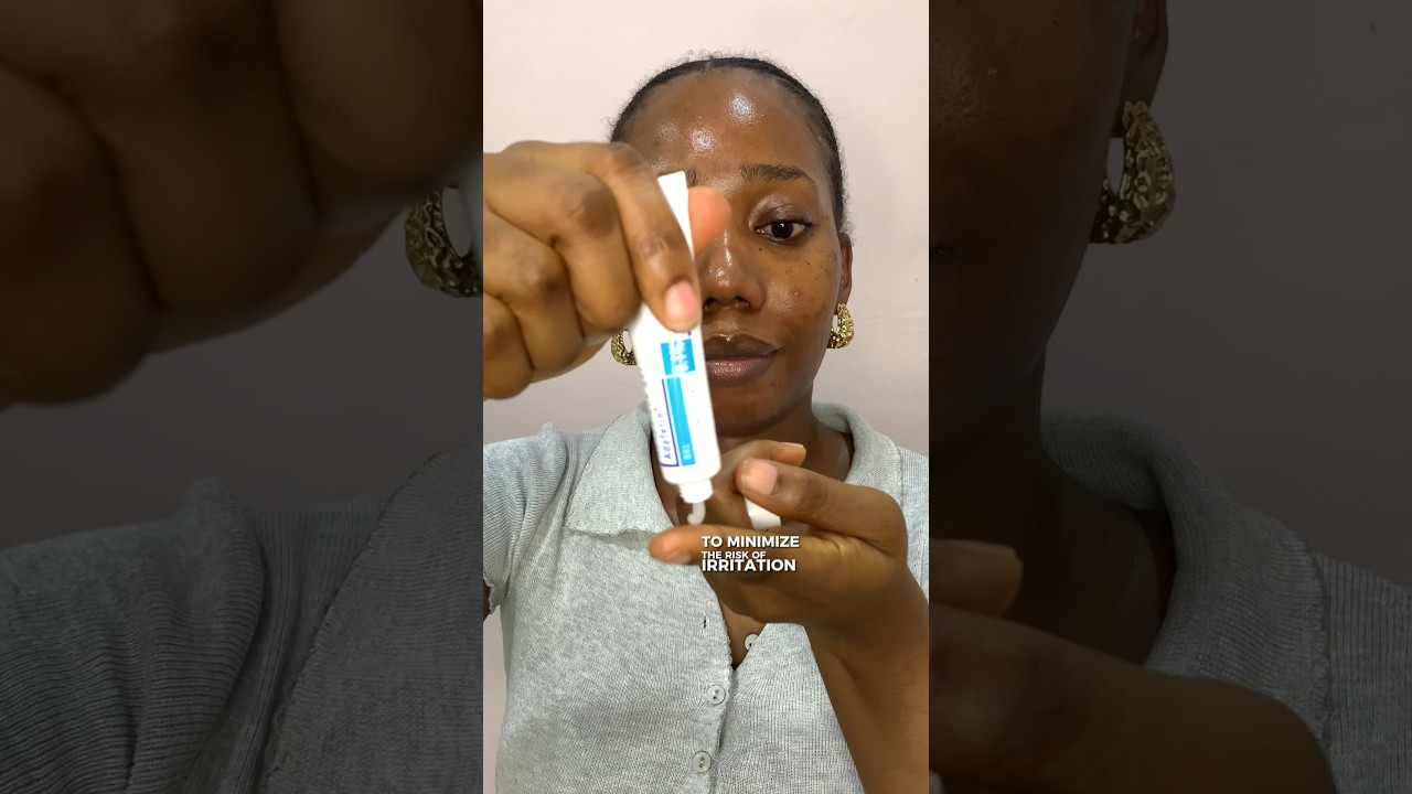 Adapalene Routine | How to Use Adapalene | Acne Treatment | Acne Prone ...