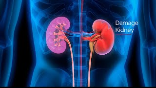 Diabetic Nephropathy [ Kidney Failure ] Kidney Diseases Diabetic Kidney Disease Animation