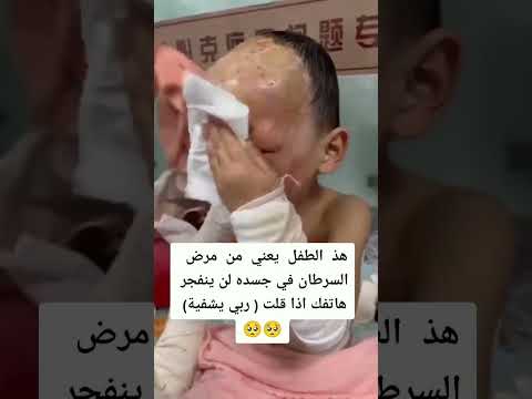 اللهم الشفاء العاجل يارب العالمين انا لله وانا اليه راجعون متابعه لايك اكسبلور 