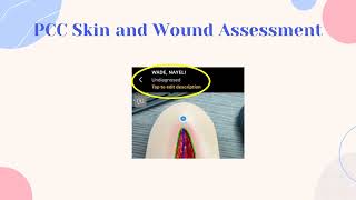 Thumbnail PCC Skin and Wound Assessment