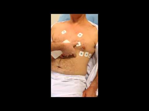 Vidéo: Comment devenir un technicien ECG : 10 étapes (avec photos)