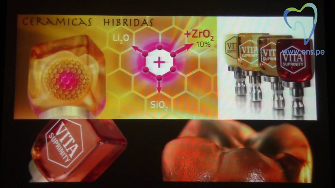Sistema de materiales cerámicos Parte 3 negocios desde casa