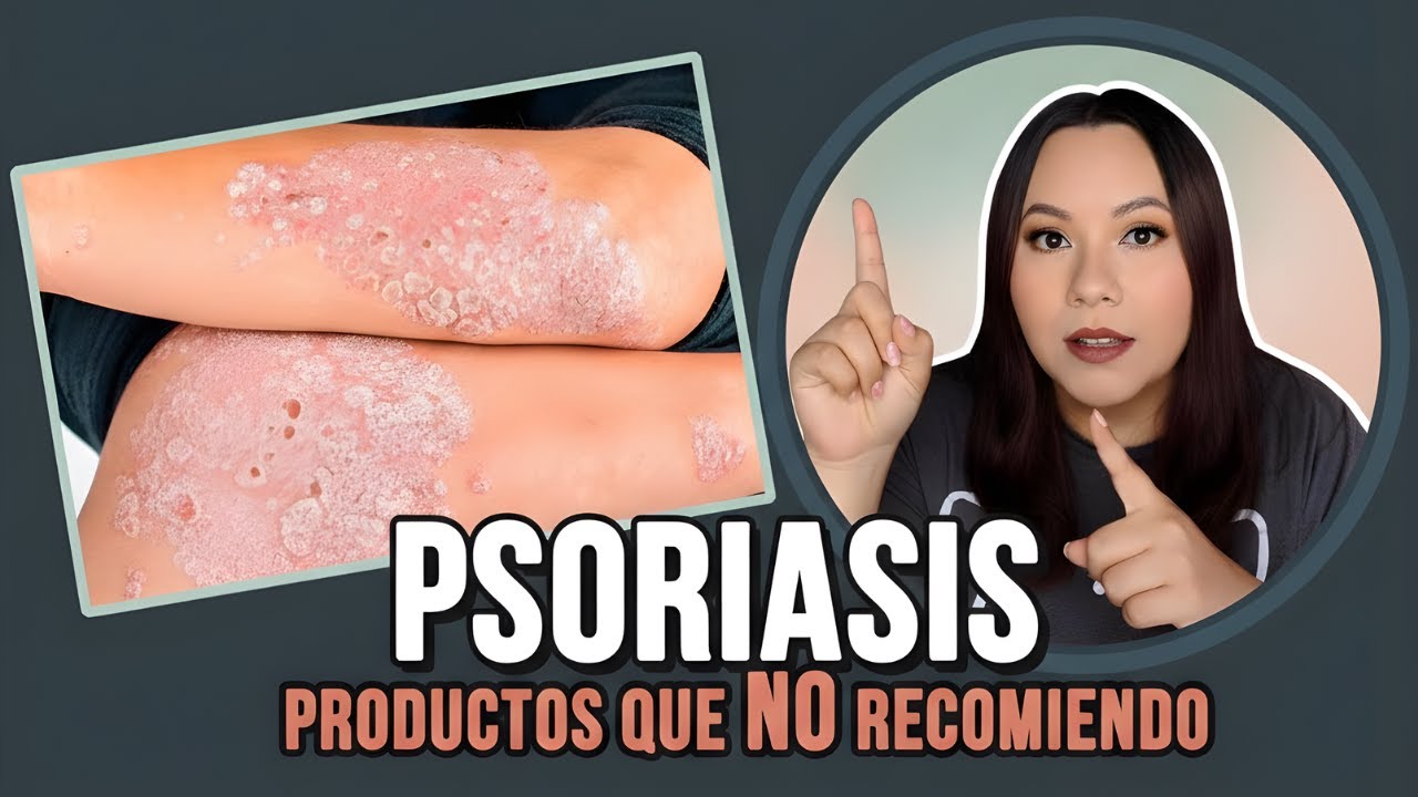 PSORIASIS - Productos que NO recomiendo
