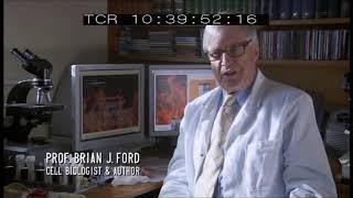Discovery Channel documentary on Spontaneous Human Combustion