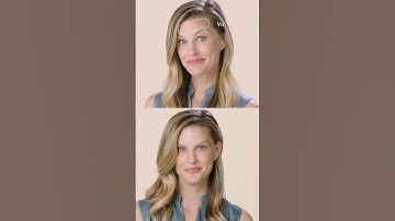 Expert BOTOX Injections In Guilford, CT #botox #botoxbeforeandafter