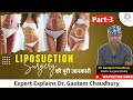 Liposuction in India | Fat Removal Surgery की पूरी जानकारी – Explained Dr. Gautam Chaudhury Part-3
