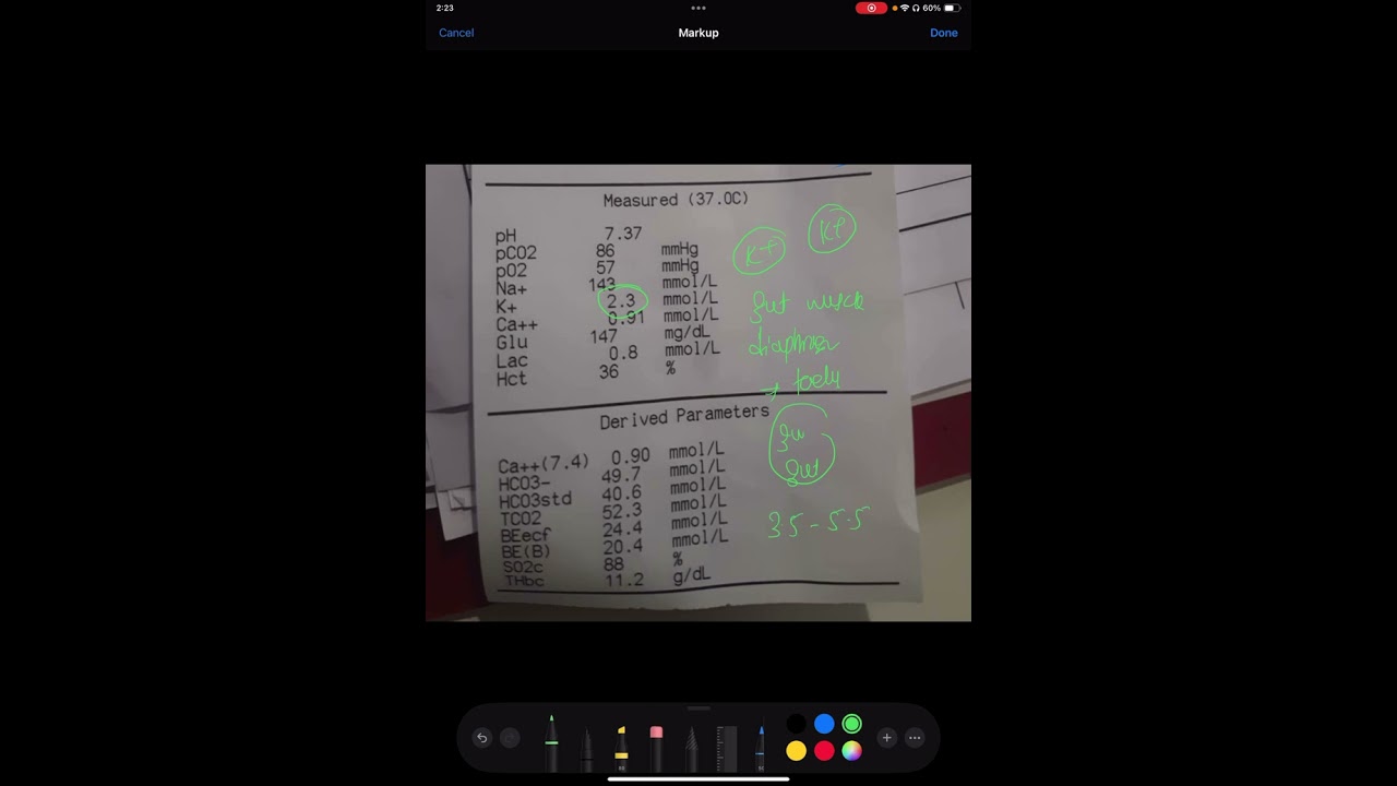 ABG- single BEST BRAMHASTRA TEST FOR VITALS OF PATIENT