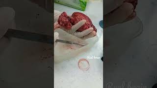 Real brain anatomy❤?                                      anatomy shorts fyp science trending