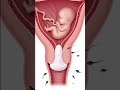 Why Sperm Can T Enter Cervical Mucus Plug Explained In 3D 