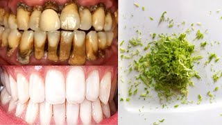 In just three minutes, white and shiny teeth like whitening pearls, teeth whitening at home