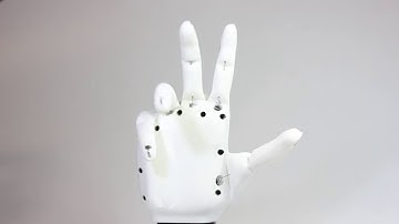 Open Bionics Ada Robotic Hand Controllable Via EMG