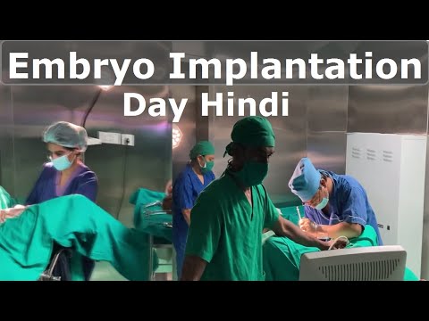 How Embryo Transfer Is Done in IVF