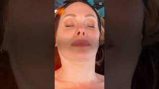 Download Lagu Micro infusion pdrn behandeling alfaskin MP3