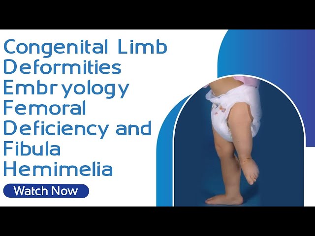 Congenital Limb Deficiency Disorders