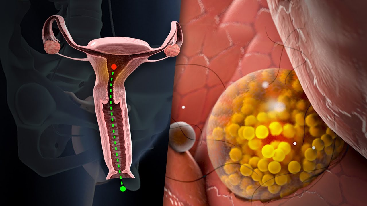 Así es el proceso de la menstruación