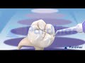 How to PREVENT CAVITIES - Dental sealants