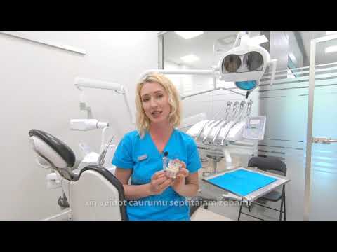 Video: Kā atjaunot zobu emalju (ar attēliem)