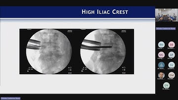 LLIF Technique : Gregory M. Mundis Jr., MD on September 30, 2024.