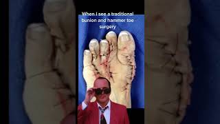 WTF! Traditional Bunion Surgery Gone WRONG!