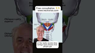 Sub occipital muscle spasm relief | Vertigo relief | Salt Lake Holistic Doctor