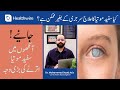 What is cataract  cataract symptoms  treatment  safaid motia ka ilaj  dr muhammad saad aziz