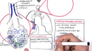 PART I - Pneumonia (Overview, Lobar and Bronchopneumonia)