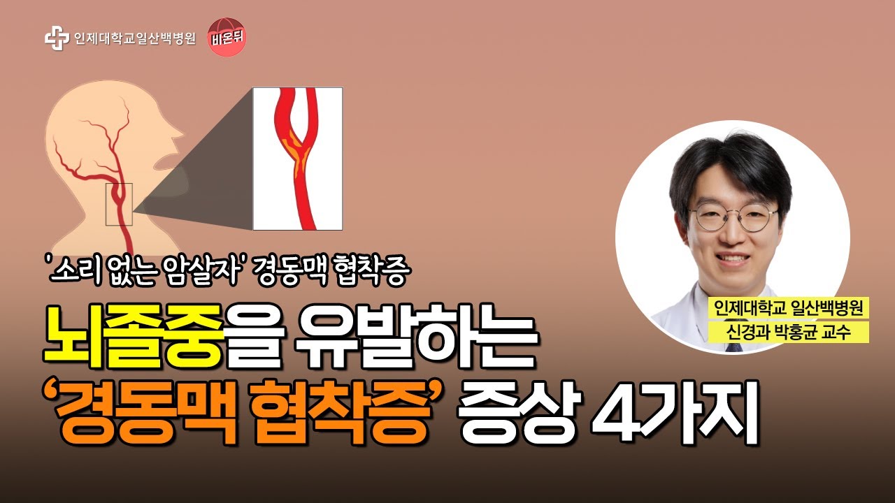 뇌졸중 유발하는 '경동맥 협착증'의 증상 4가지│일산백병원 신경과 박홍균 교수
