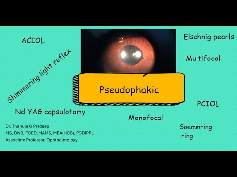 Pseudophakia - YouTube
