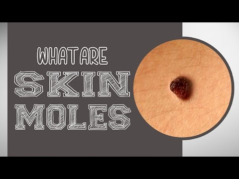 Video: Why Moles Appear