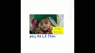 Define microcephaly  #pediatricsbydranand