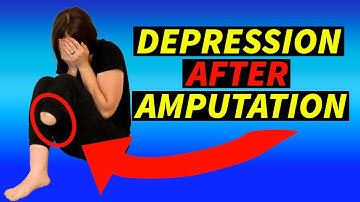 Grieving Limb Loss: Depression After Amputation