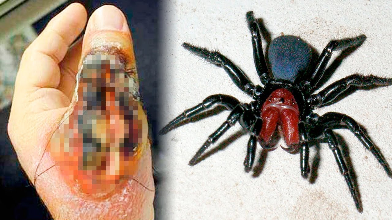 What'S The Deadliest Spider In The World?