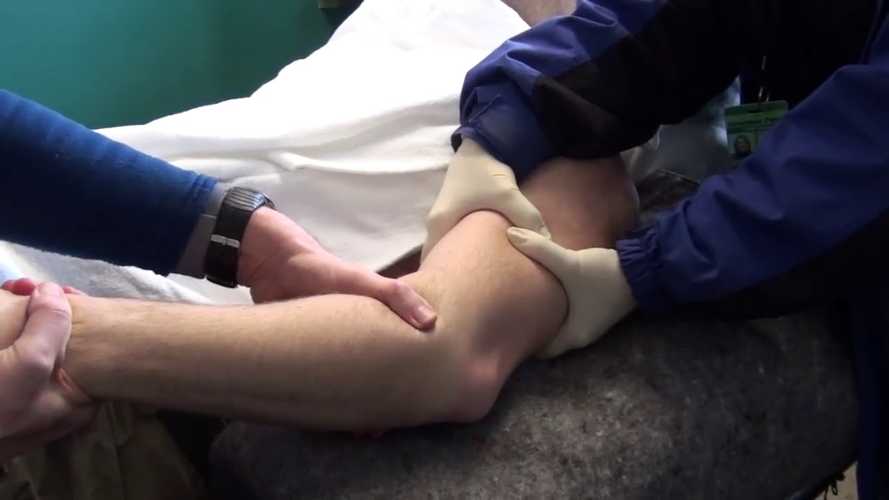 Вывих локтя