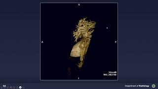 006 Biliary Imaging 2023 with Emphasis on MRCP Medstudylab.com